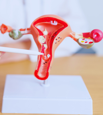 Herbal Cocktails to Treat Infertility in Women